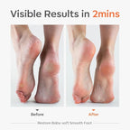 Modelones Glass Foot File, Professional Foot Scrubber and Callus Remover - Image 8