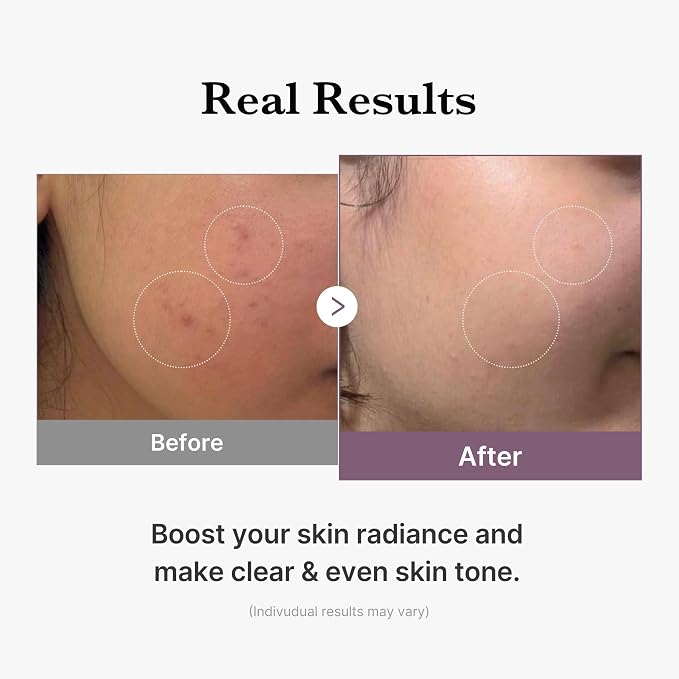 medicube Age-R Glutathione Glow Milky Toner, Low-Irritation Double Layer Toner - Image 5