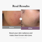 medicube Age-R Glutathione Glow Milky Toner, Low-Irritation Double Layer Toner - Image 5