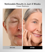 INIA Red Light Therapy Mask for Face – 4 Light Modes - Image 6