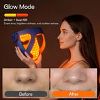 INIA Glow 4D Wireless Red Light Therapy Mask - Image 6
