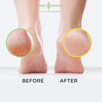 DAILY REMEDY EXTRA STRENGTH Tea Tree Oil & Citrus Detox Foot Soak Set - Image 5