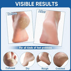Nano Glass Foot File, Foot Callus Remover & Scrubber - Image 7