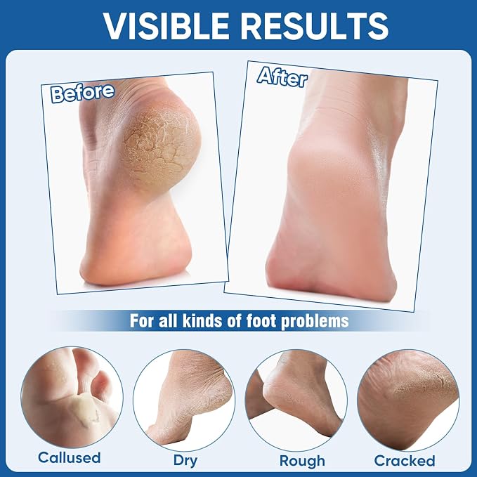 Nano Glass Foot File, Foot Callus Remover & Scrubber - Image 7