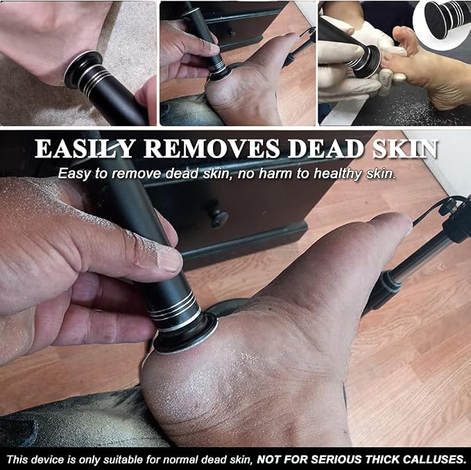 Upgraded Electric Callus Remover - Image 4