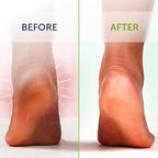 14oz Tea Tree Oil Foot Soak - Image 8