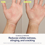 Skinfix Hand Relief Cream - Image 3