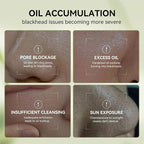 LANBENA 3-in-1 Blackhead Removal Set - Image 3