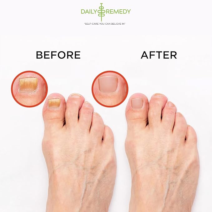 Muscle Relief Foot Soak with Epsom Salt, Made in USA, Soothe Tired Feet - Image 6
