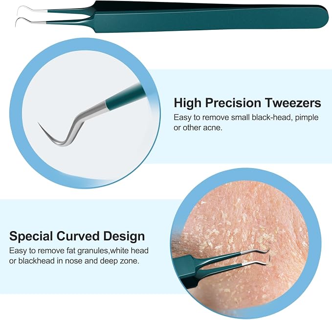 Blackhead Remover Tools Pimple Popper Tool Kit Comedones Extractor Acne Removal - Image 4