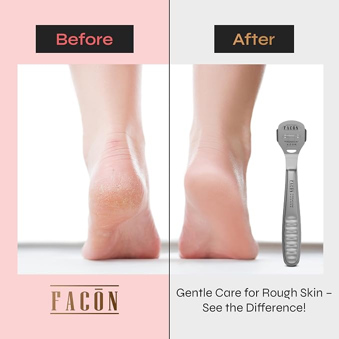 Facón Professional Callus Shaver Remover - Image 3