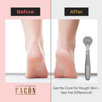 Facón Professional Callus Shaver Remover - Image 3
