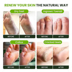 FOOT CURE Tea Tree Oil Foot Soak - Image 6
