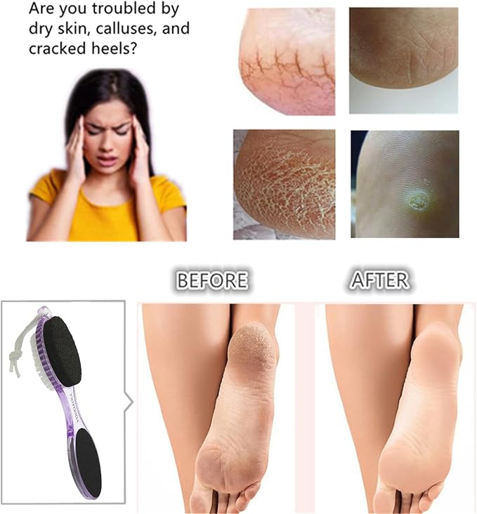 Foot File Callus Remover 4-in-1, Feet Scraper Pedicure Tools - Image 3