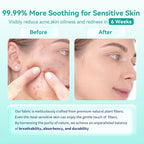 Face Towels, Face Towelettes XL, Ultra Soft Makeup Remover Dry Wipes, Thick - Image 5