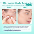 Face Towels, Face Towelettes XL, Ultra Soft Makeup Remover Dry Wipes, Thick - Image 5