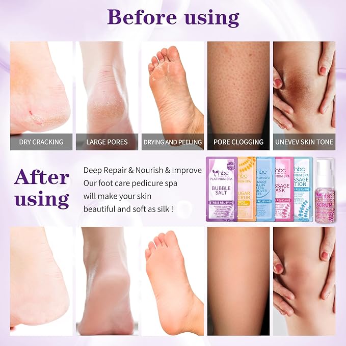 Pedicure Kit Foot Soak Set: Bubble Salt, Sugar Scrub, Massage Mask, Massage - Image 4