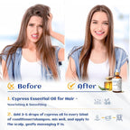 HIQILI 100ML Cypress Essential Oil, 100% Natural - Image 2