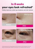 ISOI Blemish Care Under Eye Patch - Image 3