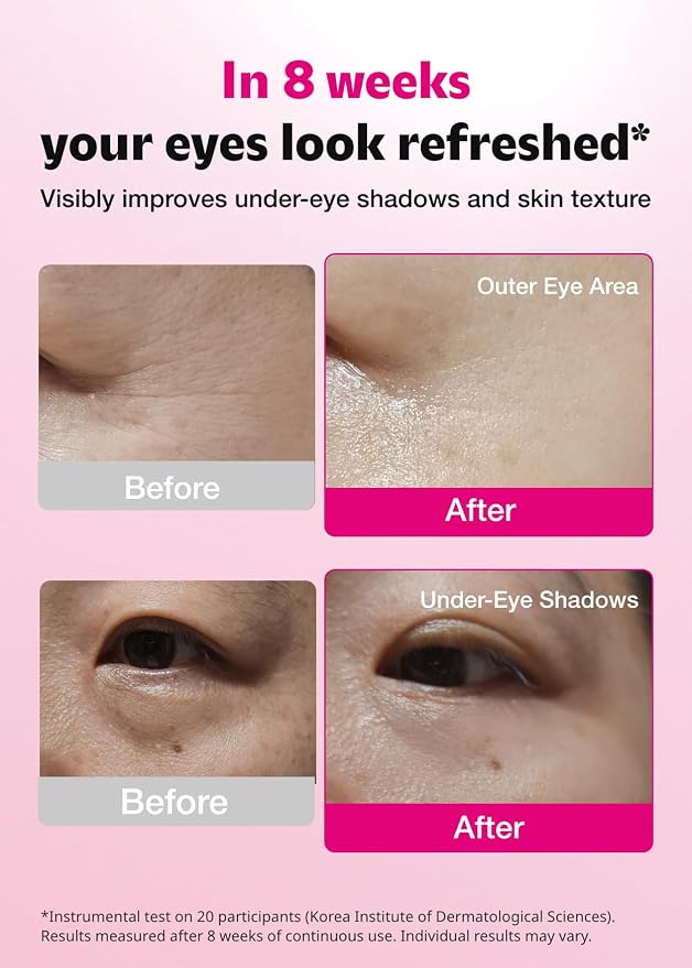ISOI Blemish Care Under Eye Patch - Image 3