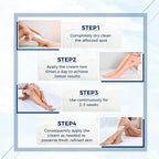 OUKEYA Urea Cream 40 Percent, Foot & Hand Cream - Image 4