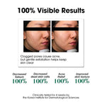 SOME BY MI AHA BHA PHA 30 Days Miracle Toner – Pack of 2 – Korean Salicylic - Image 4