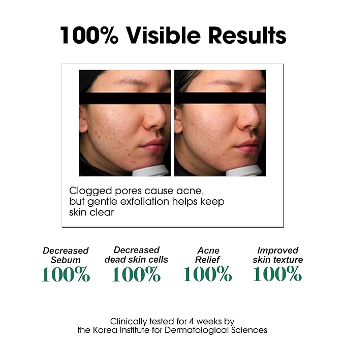 SOME BY MI AHA BHA PHA 30 Days Miracle Toner – Pack of 2 – Korean Salicylic - Image 4