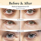 BLOOMORA Vitamin C & Caffeine Under Eye Patches, Under Eye Mask - Image 4