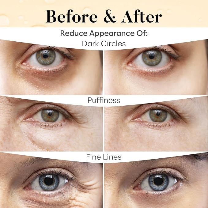 BLOOMORA Vitamin C & Caffeine Under Eye Patches, Under Eye Mask - Image 4