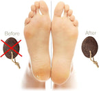 Pumice Stones for Feet - Image 5