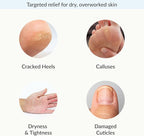Epielle Intensive Repairing Hand & Foot Masks, Restore and Moisturize Dry - Image 4