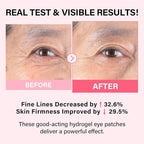 iMethod PDRN Collagen Boost Eye Patches - Image 2