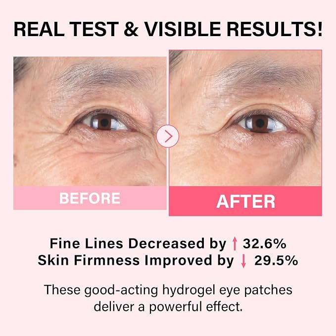 iMethod PDRN Collagen Boost Eye Patches - Image 2