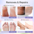 Deluxe Pedicure Kit 5 Step Spa Set – Epsom Salt Soak, Callus Remover Gel - Image 6