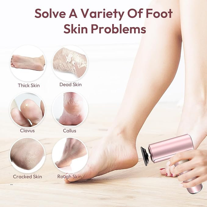 Electric Foot Callus Remover - 2 in 1 Rechargeable Electric Callus Remover - Image 7