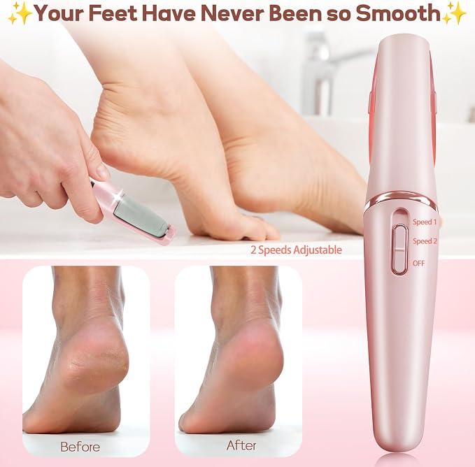 Callus Remover for Feet, ZABOUL Electric Foot Callus Remover Rechargeable - Image 3