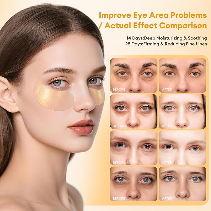 Under Eye Patches Gold Essence Hydrogel Eye Masks - Image 2