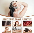 Meartchy Silicone Scalp Massager Shampoo Brush, Scalp Brush - Image 4