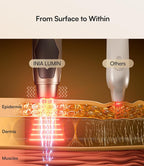 INIA 4-in-1 Eye Massager Tool Under Eye Red Light Therapy - Image 3