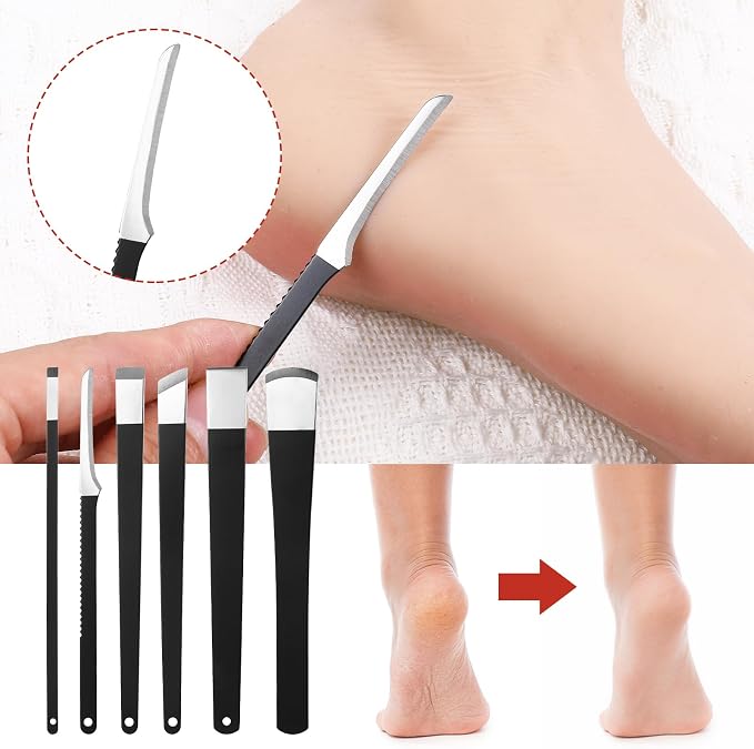 cobee 6 Pcs Ingrown Toenail Removal Kit, Callus Shaver Ingrown Toenail Tool - Image 3