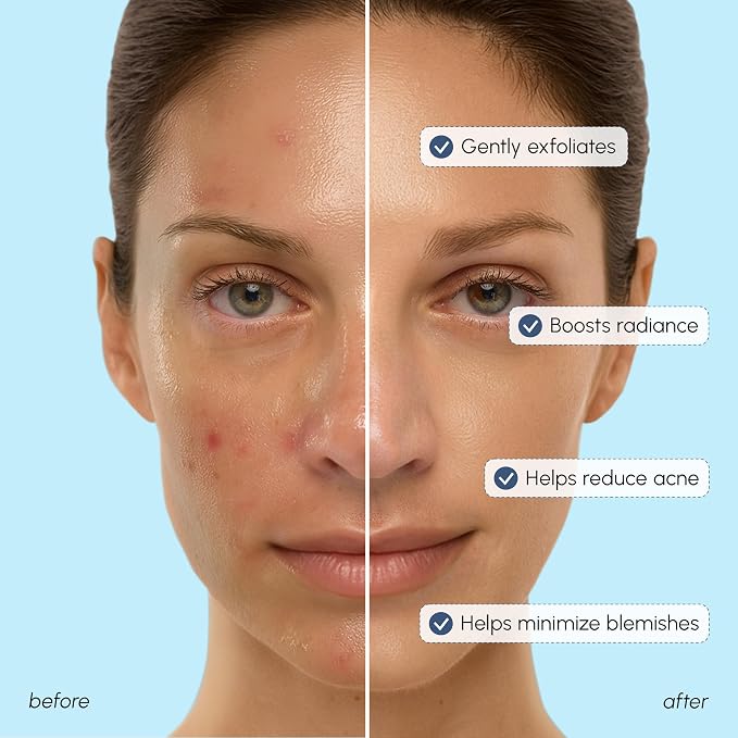 MAREE Toner Glycolic Acid Exfoliating Toner - Image 3