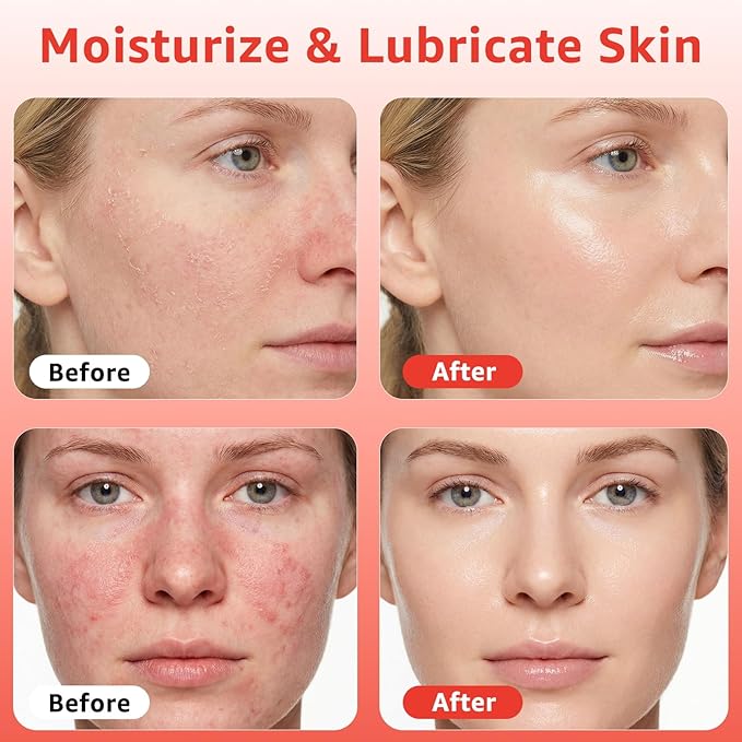Red Light Therapy Serum, Vitamin E Redlight Serum - Image 2