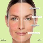 MAREE Blemish Acne Clearing Polishes - Image 5