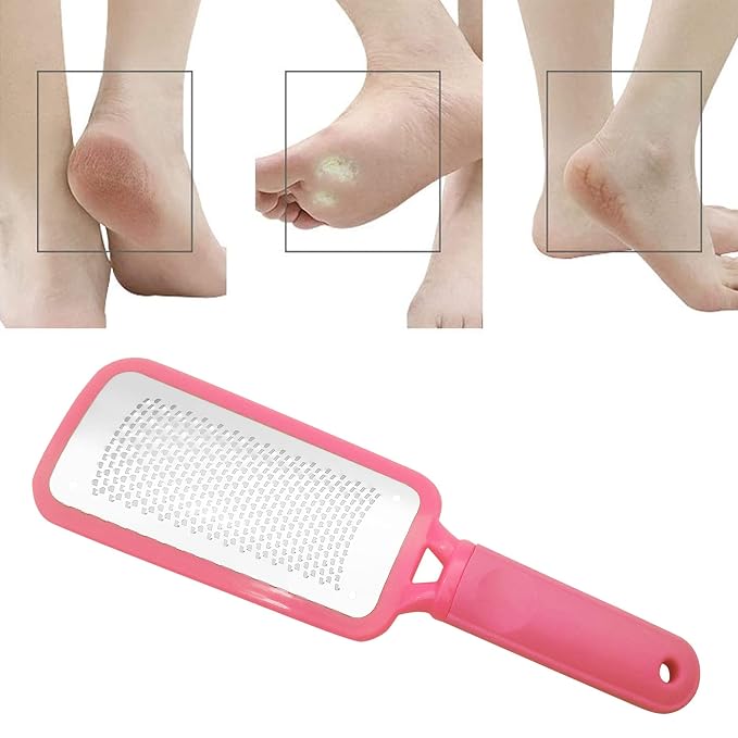 Professional Foot Files Callus Remover, Foot Scrubber - Image 5