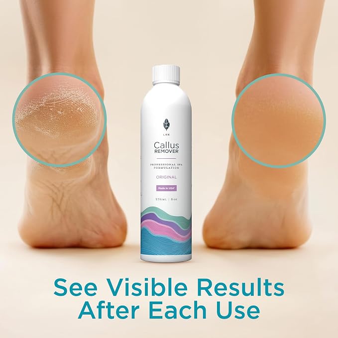 Lee Beauty 8oz Professional Gel Callus Remover - Image 4