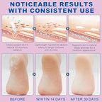 Urea Foot Care Stick, Foot Cream Moisturizer - Image 2