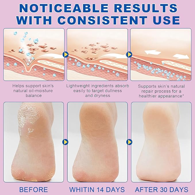 Urea Foot Care Stick, Foot Cream Moisturizer - Image 2