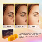 VALITIC Kojic Acid Dark Spot Remover Soap Bars - Image 2