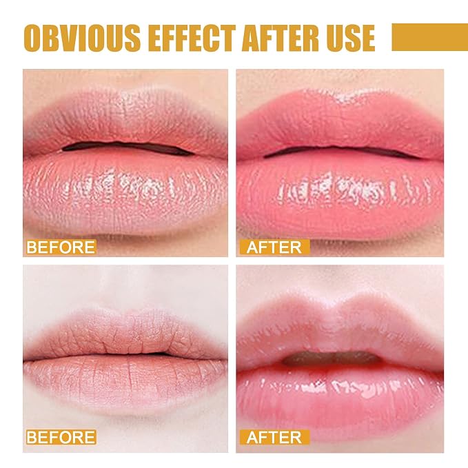 2 Pcs Lip Balm Honey Pot, Honey Moisturizing Lip Mask Reduces Lip Lines and - Image 5