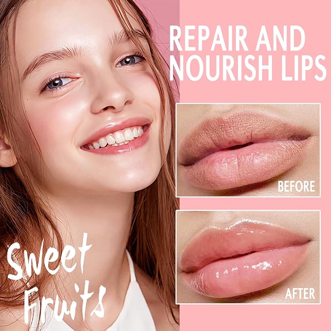 10 PCS Bee Lip Balm Lip Mask Honey Pot, Mothers Day Gifts, Teacher Appreciation - Image 2
